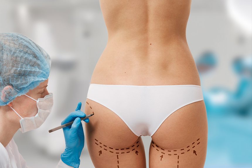 Emsculpt® vs Brazilian Butt Lift