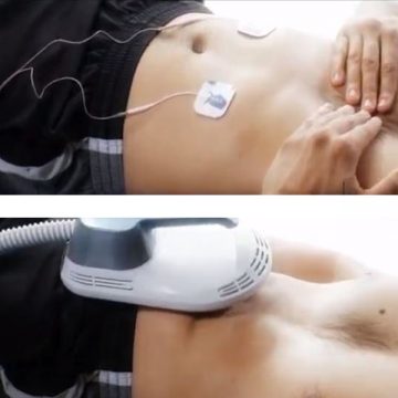 Emsculpt® Vs The Tens Unit